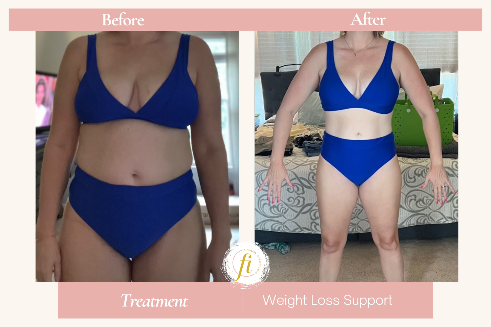 Flawless Imperfections Med Spa, LLC