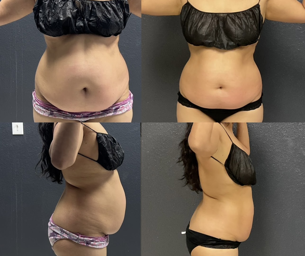 Grace Medspa & Body Solutions