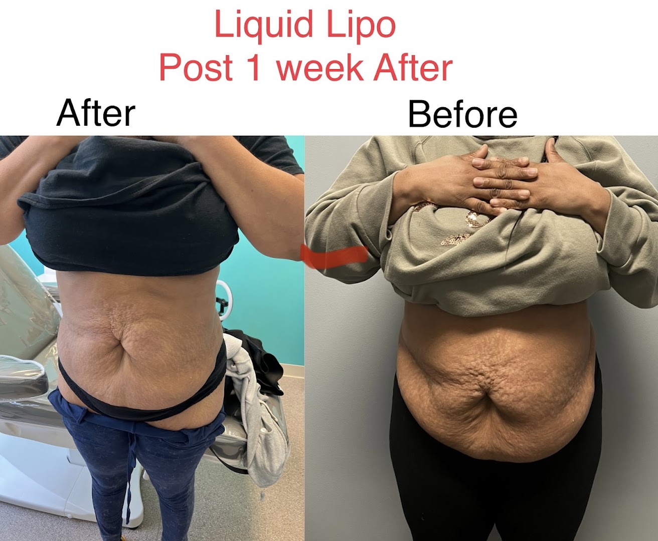 Body Goals MedSpa & Aesthetics