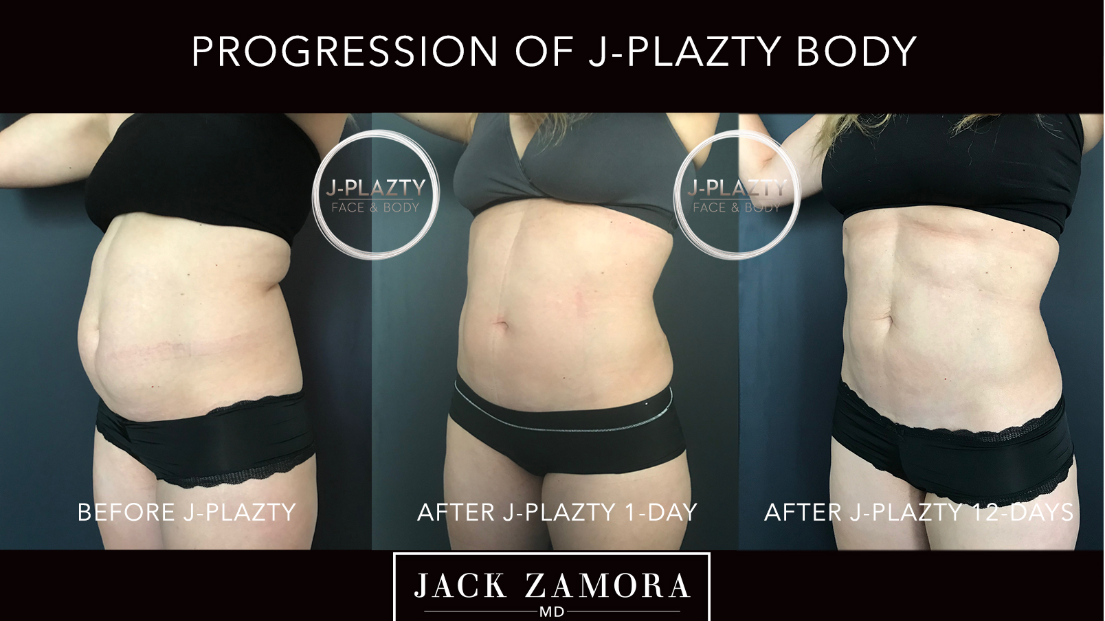 Jack Zamora MD Cosmetic Surgery and Aesthetics