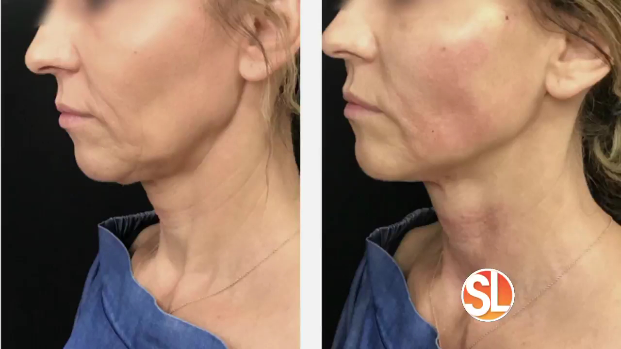 Glo Medspa